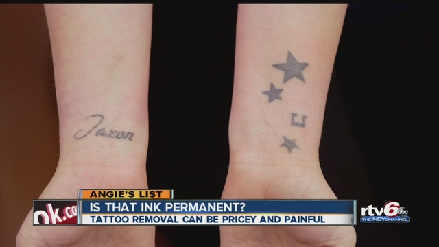 angie u0027s list tattoo removal can be pricey painful angie u0027s list tattoo removal can be pricey painful