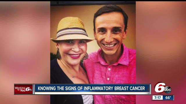 Inflammatory breast cancer may not show up in routine ...